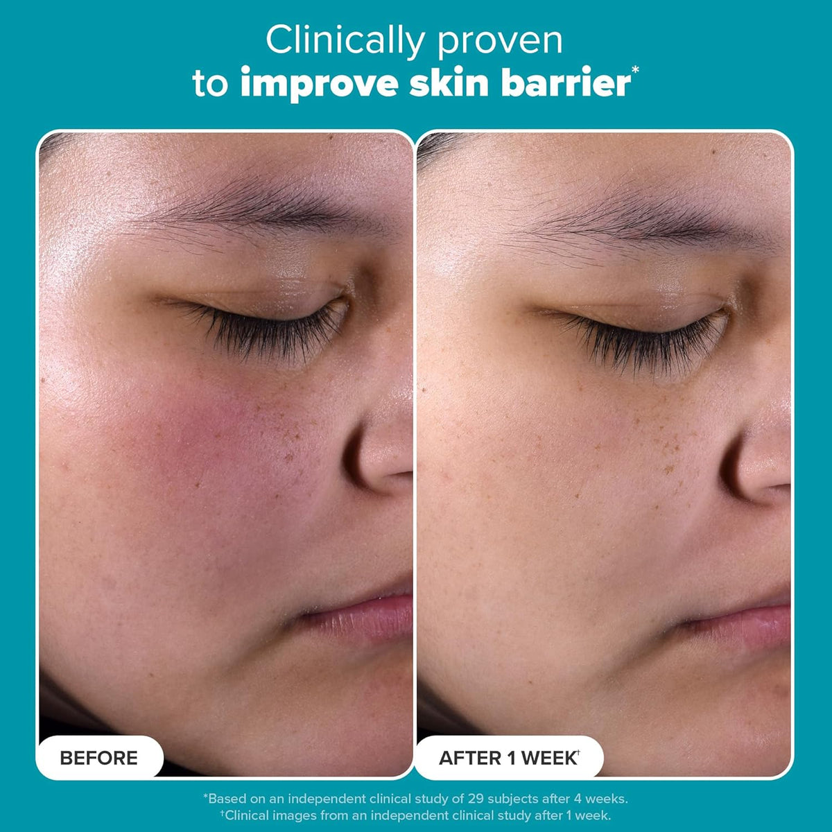 Paula's Choice 2% BHA Liquid Exfoliant - Application & Usage Demonstration | buy online in India with doorstep delivery at Cu