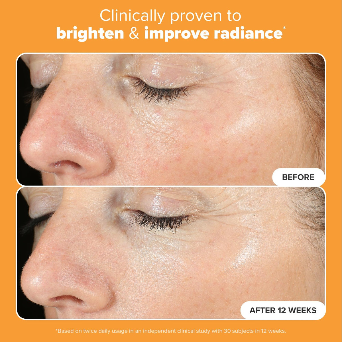 Experience visible skin transformation with Paula's Choice BOOST C15 Super Booster, proven to brighten and enhance radiance.