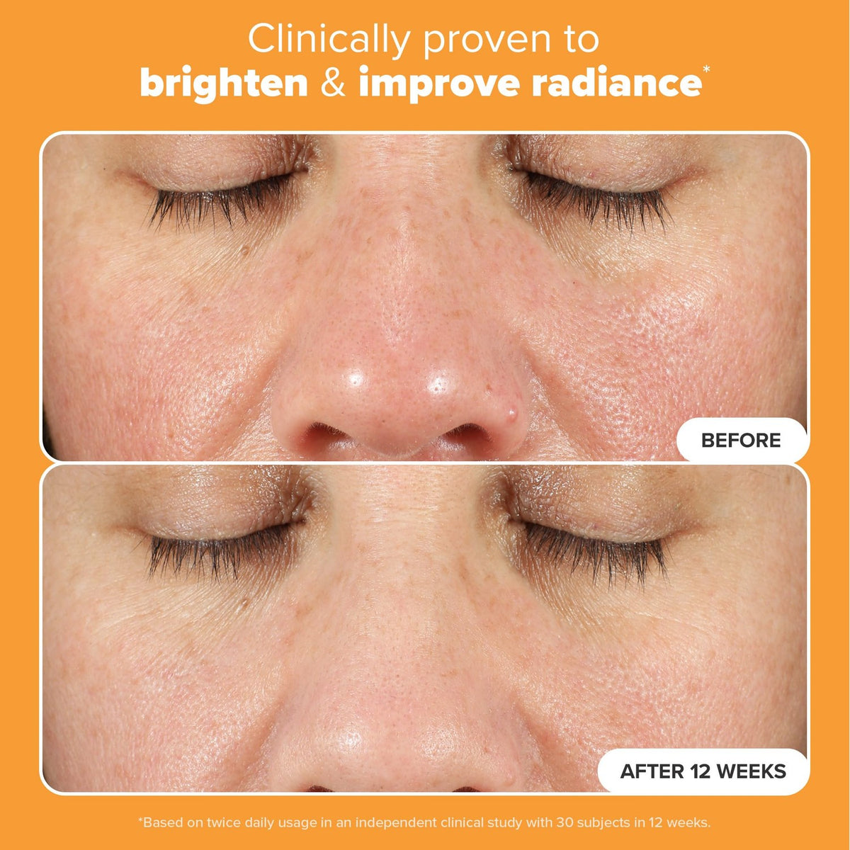 Visible results of Paula's Choice BOOST C15 Super Booster, enhancing skin radiance. Verified by CuratCart for quality assurance.