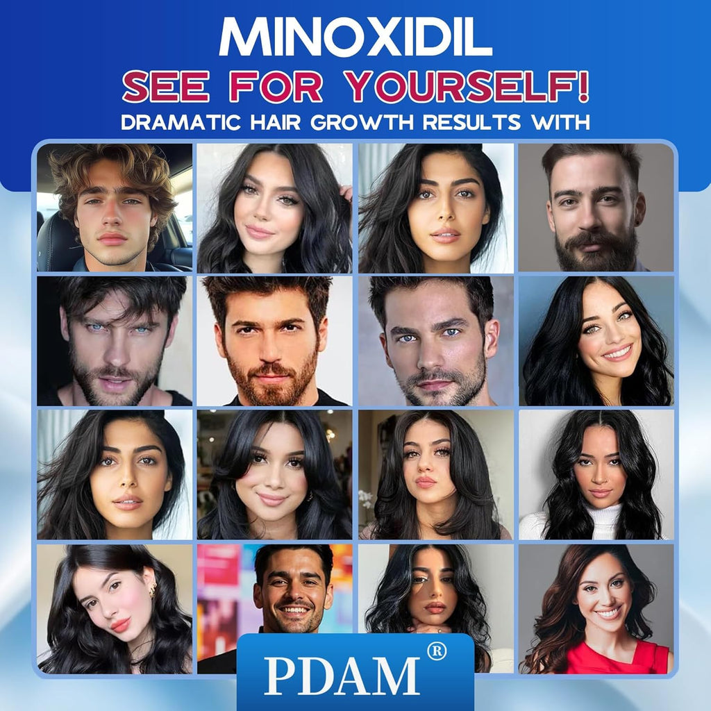 Experience PDAM Minoxidil Foam for Hair Regrowth, specially curated by Curat Cart for dramatic hair growth results.