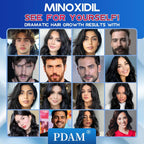 Experience PDAM Minoxidil Foam for Hair Regrowth, specially curated by Curat Cart for dramatic hair growth results.