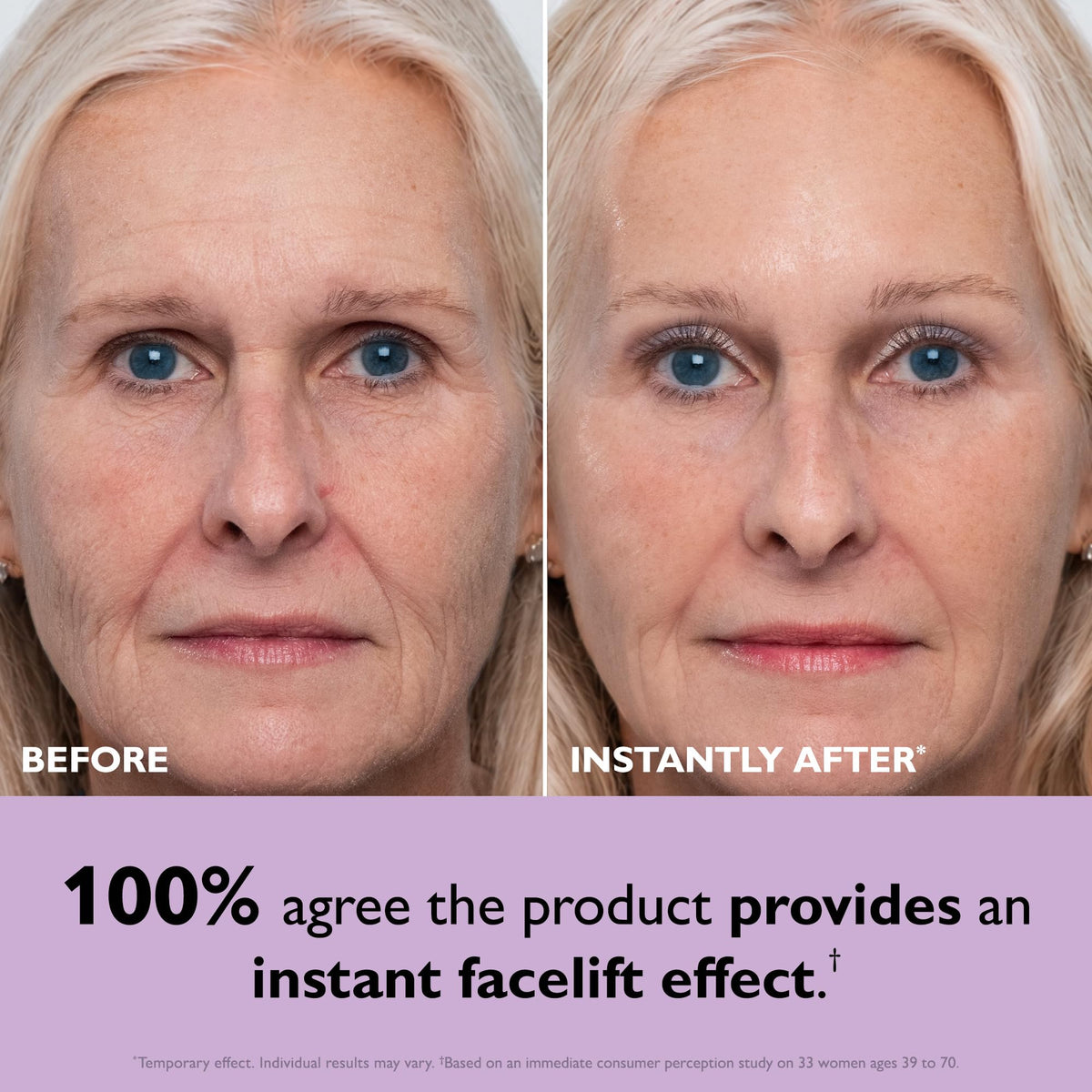 Before and after using Peter Thomas Roth Instant FIRMx Face Tightener, showing visible tightening effects on skin.