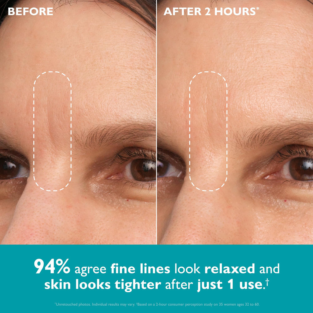 Image shows skin before and after using Peter Thomas Roth Peptide Skinjection™, highlighting smoother, tighter skin.