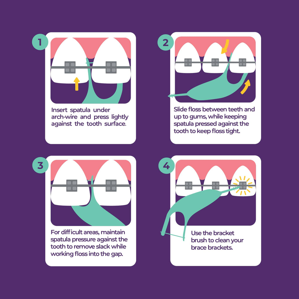 Discover how Platypus Orthodontic Flossers work with this step-by-step guide, specially curated by Curat Cart for optimal dental care.