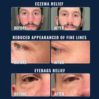 Experience the Prettyboy Fresh Start Face Cleanser for eczema relief, fine lines reduction, and eye bags remedy. Exclusively at Curat Cart.