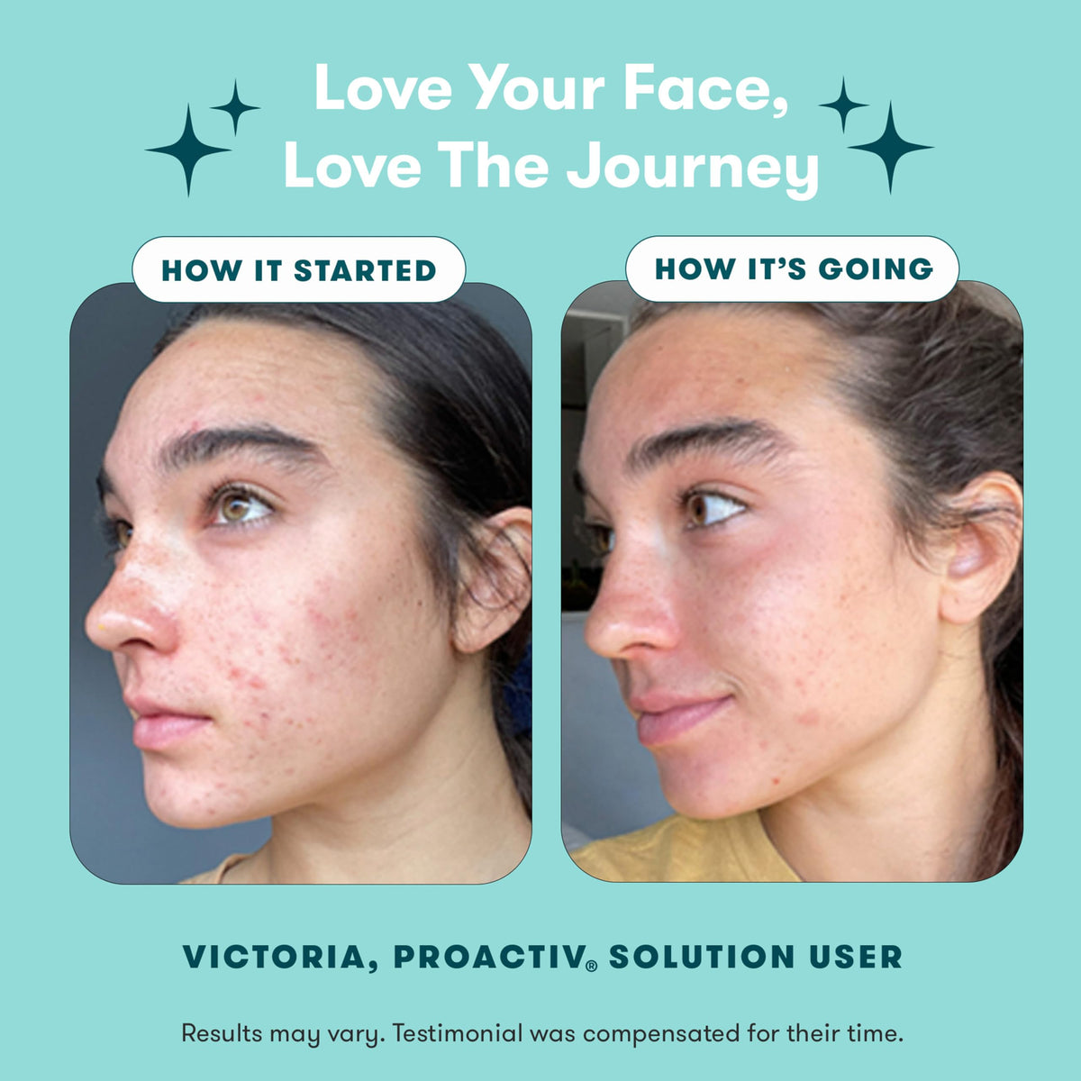Transform your skin with Proactiv's imported acne treatment kit. Experience visible results for clearer skin today.