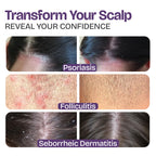 Transform your scalp with our Psoriasis Shampoo, specially curated by Curat Cart for effective relief and confidence.