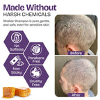 Psoriasis Shampoo with Scalp Scrubber in official packaging, showcasing effective results for sensitive skin. Available at Curat Cart.