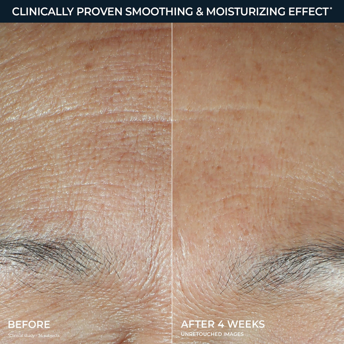 Side-by-side comparison showing skin texture before and after using RoC Hyaluronic Acid Night Serum Capsules for four weeks.