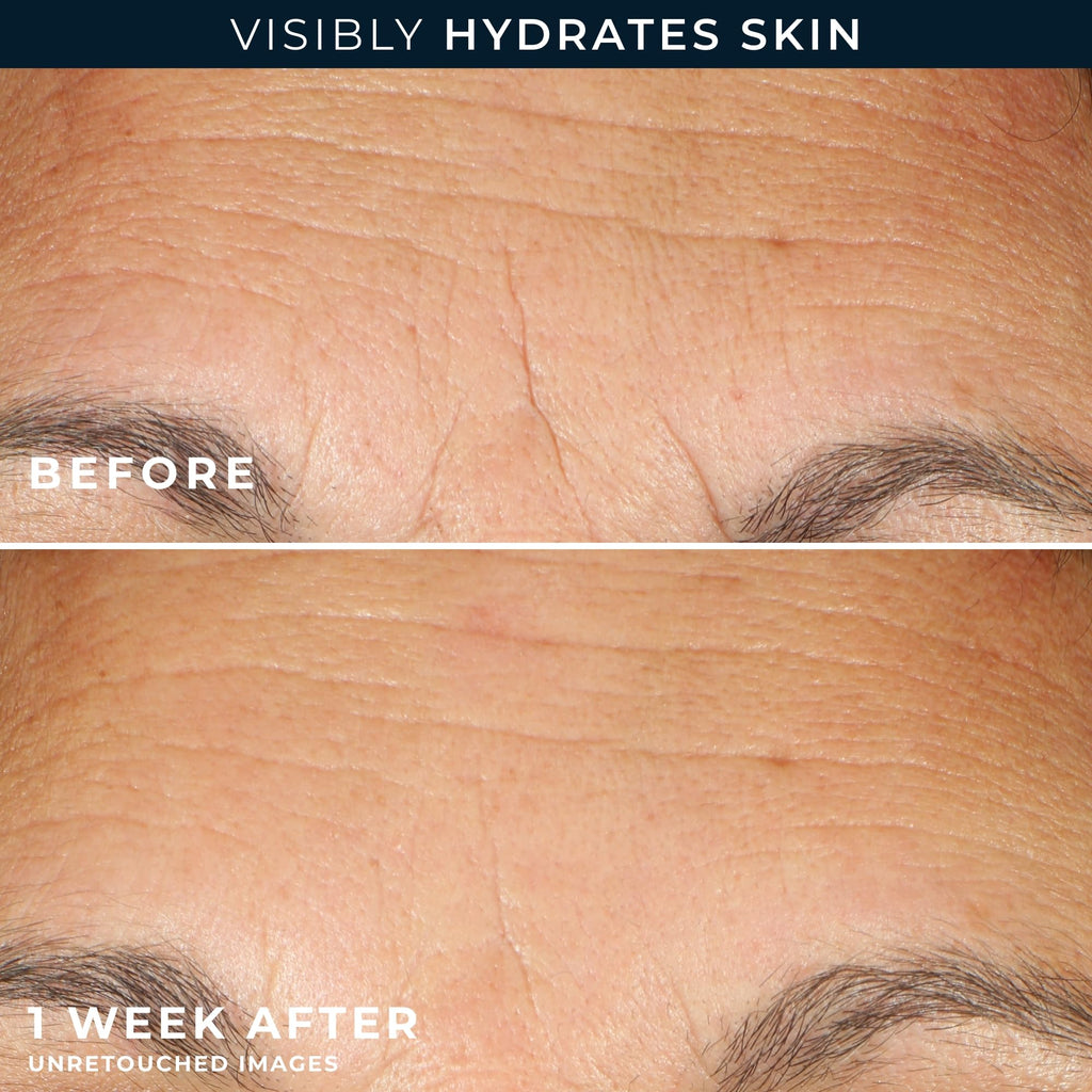 Before and after images showing visibly hydrated skin with RoC Hyaluronic Acid Night Serum Capsules, verified by CuratCart.