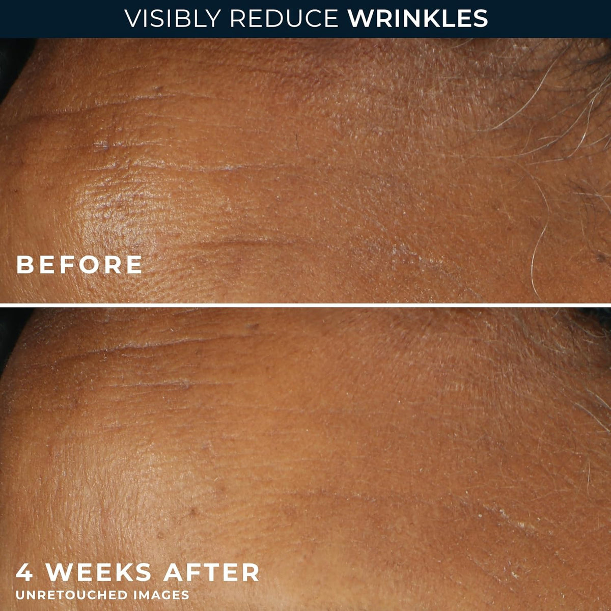 Visual results showcasing RoC Retinol Correxion Face Moisturizer's effectiveness in reducing wrinkles after four weeks.