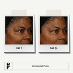 Witness the power of Rodan + Fields Redefine Cream through unretouched photos showcasing visible skin improvement. Perfect for daily use. Available at Curat Cart.
