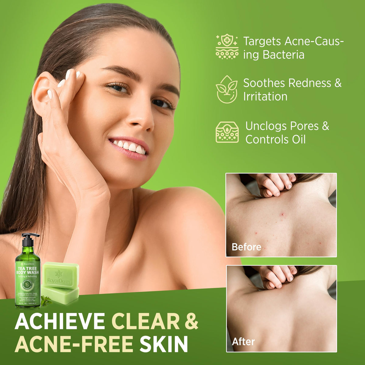 Roycederm Tea Tree Body Wash and Soap set, designed for clear skin, targets acne while soothing irritation and controlling oil.