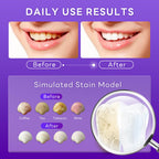 Transform your smile with SAKYPRORAL Whitening Toothpaste, specially curated by Curat Cart for daily use. Discover the difference.