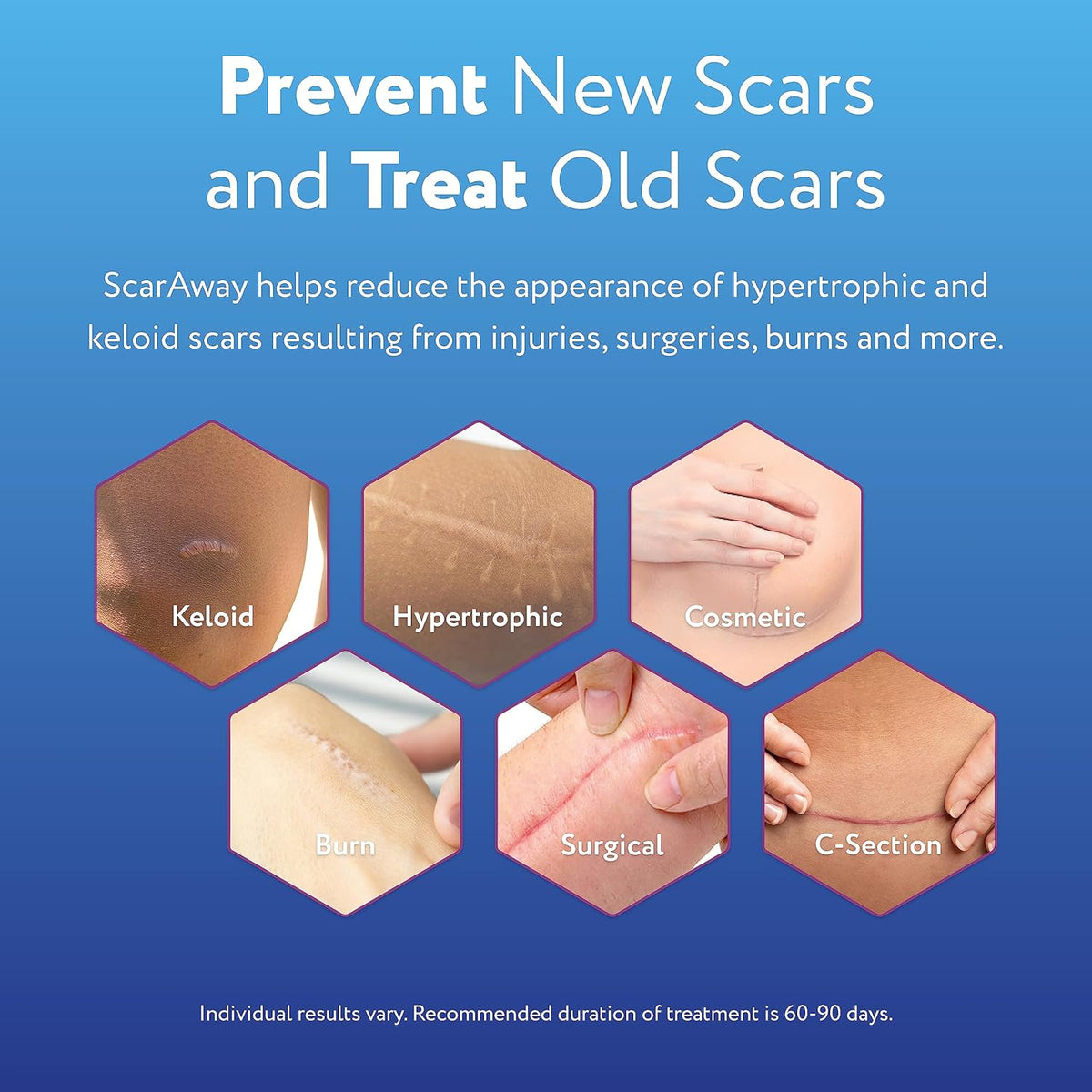 ScarAway Medical-Grade Silicone Scar Gel helps prevent new scars and treat old scars. Order online in India today.