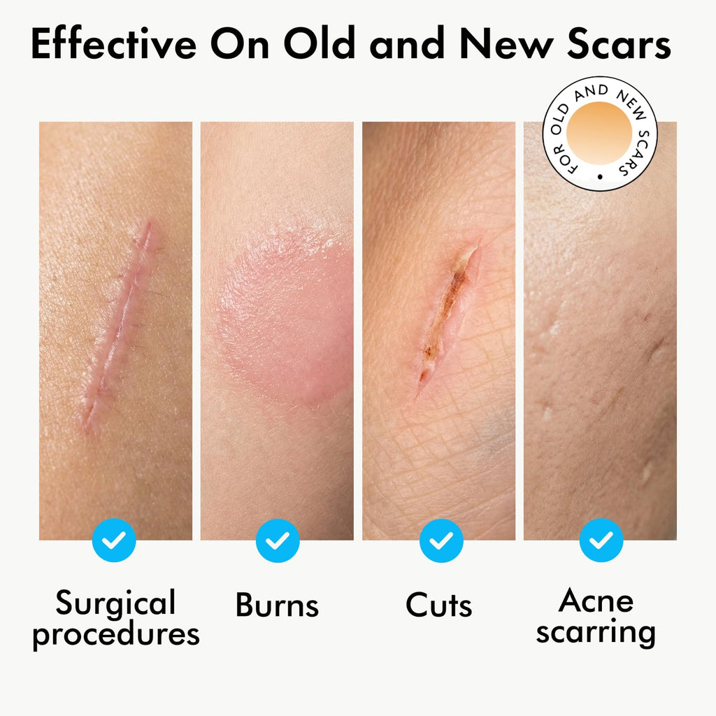 Serica Scar Gel Silicone Formula showcases effectiveness on old and new scars, featuring high-quality packaging for optimal results. Available at Curat Cart.
