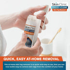 Tackle skin tags with Skin Clinic Skin Tag Remover, specially curated by Curat Cart for quick, easy at-home removal.