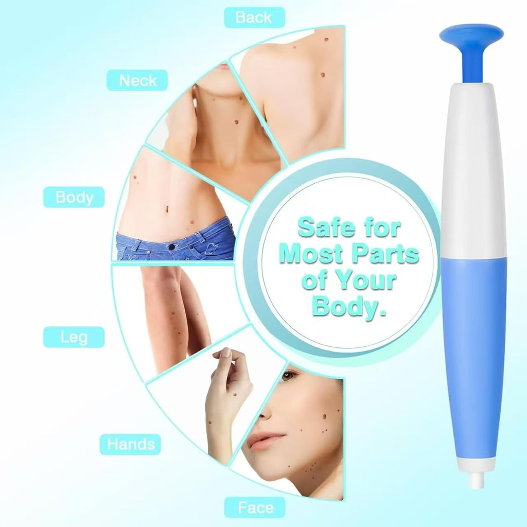 Discover the Skin Tag Remover Device, specially curated by Curat Cart, safe for most body parts including face and legs.
