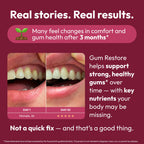 Strong Jaw Gum Restore enhances gum health over time. Premium import from Curat Cart, featuring real user results. Discover comfort today.