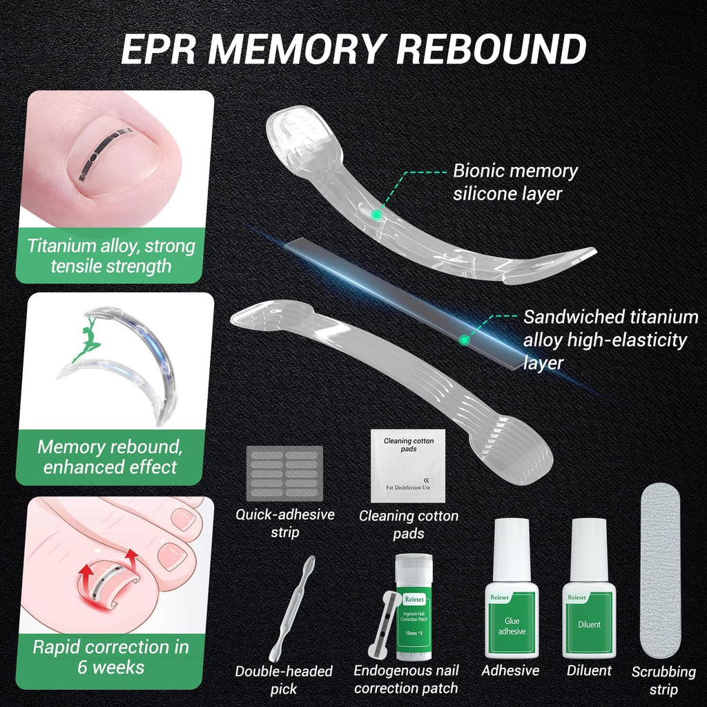Ingrown toenail treatment featuring titanium alloy tools, memory rebound design, and adhesive silicone elements in original packaging.