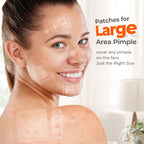 Premium imported TKTK large pimple patches effectively cover blemishes on face and body for quick healing.