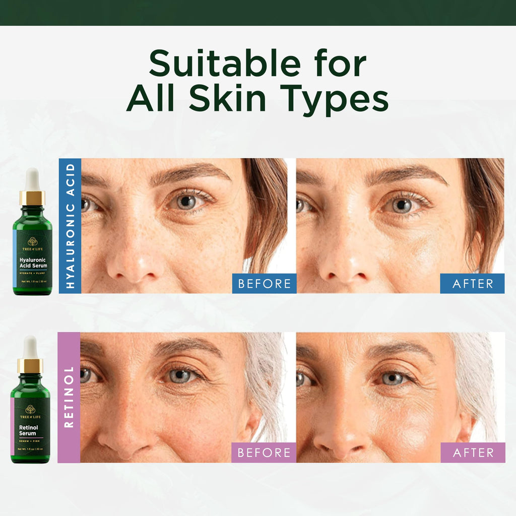 Tree of Life Face Serum, featuring hyaluronic acid and retinol for all skin types. Authentic results shown in before and after images.