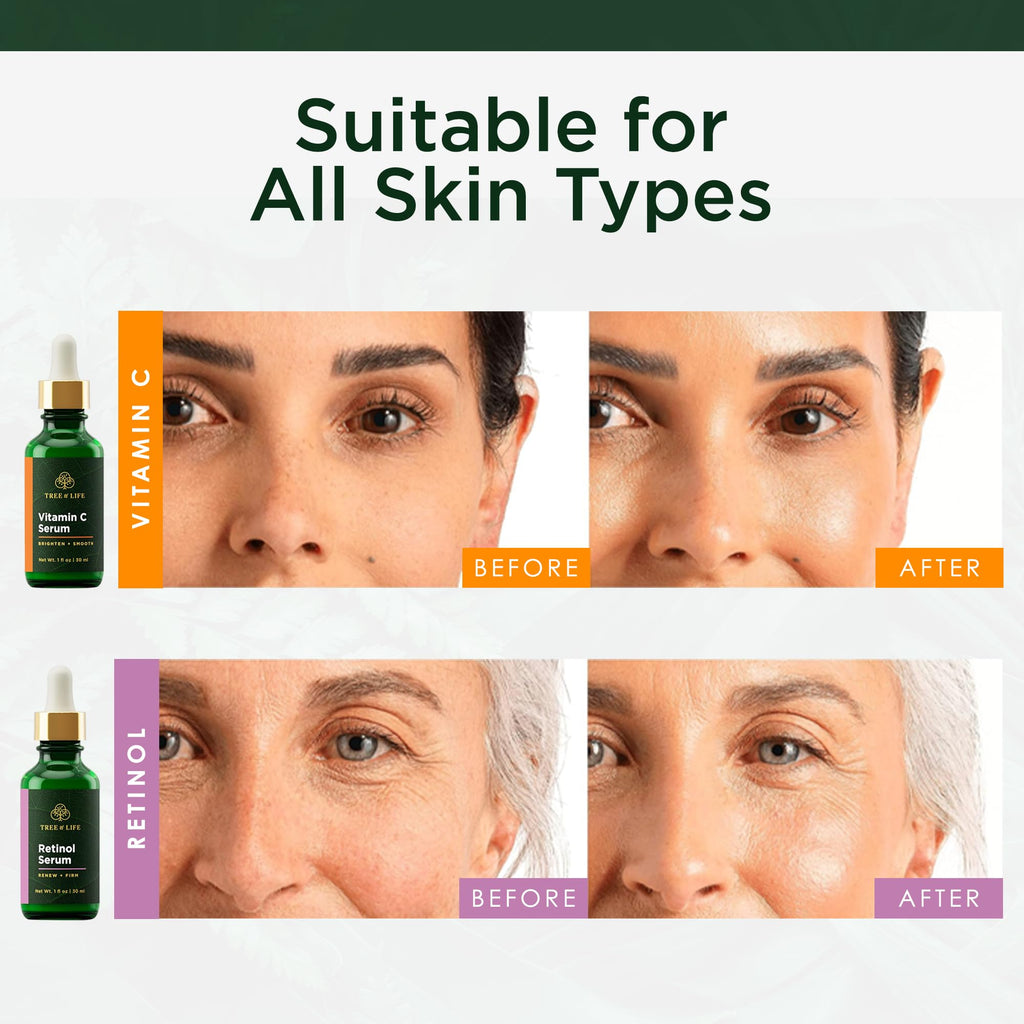 Premium imported Tree of Life Face Serum suitable for all skin types. Features Vitamin C and Retinol for glowing skin.