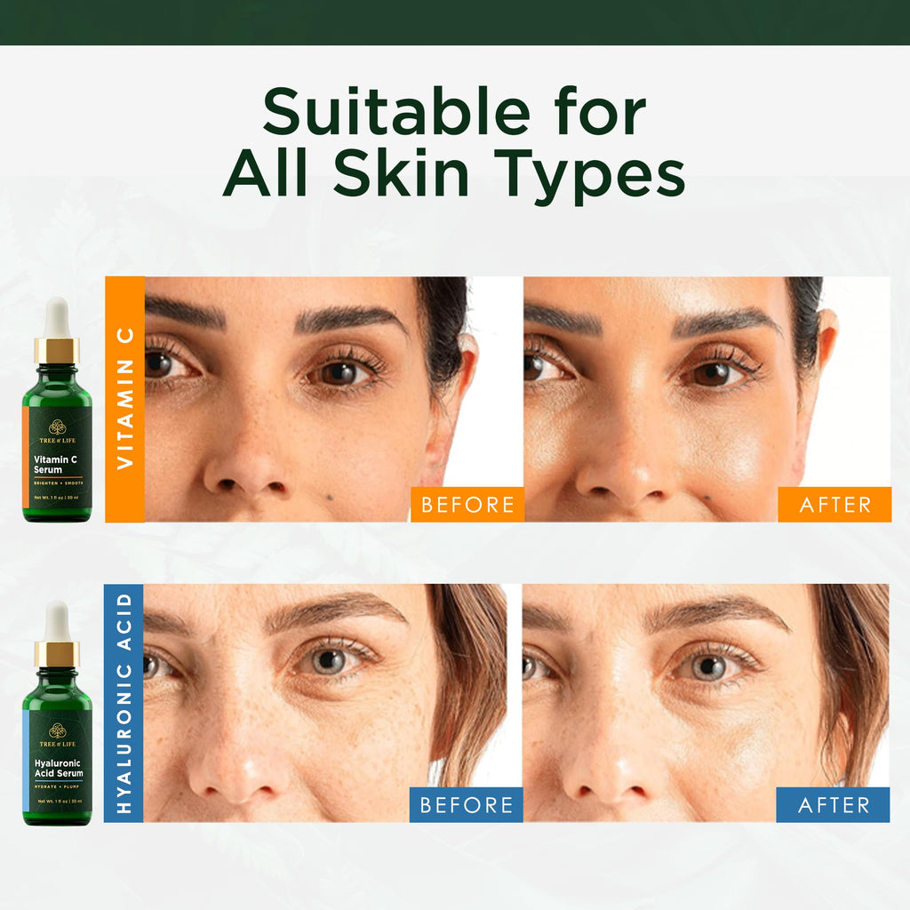 Transform your skin with Tree of Life Face Serum, featuring Vitamin C and Hyaluronic Acid. Available online, order now!