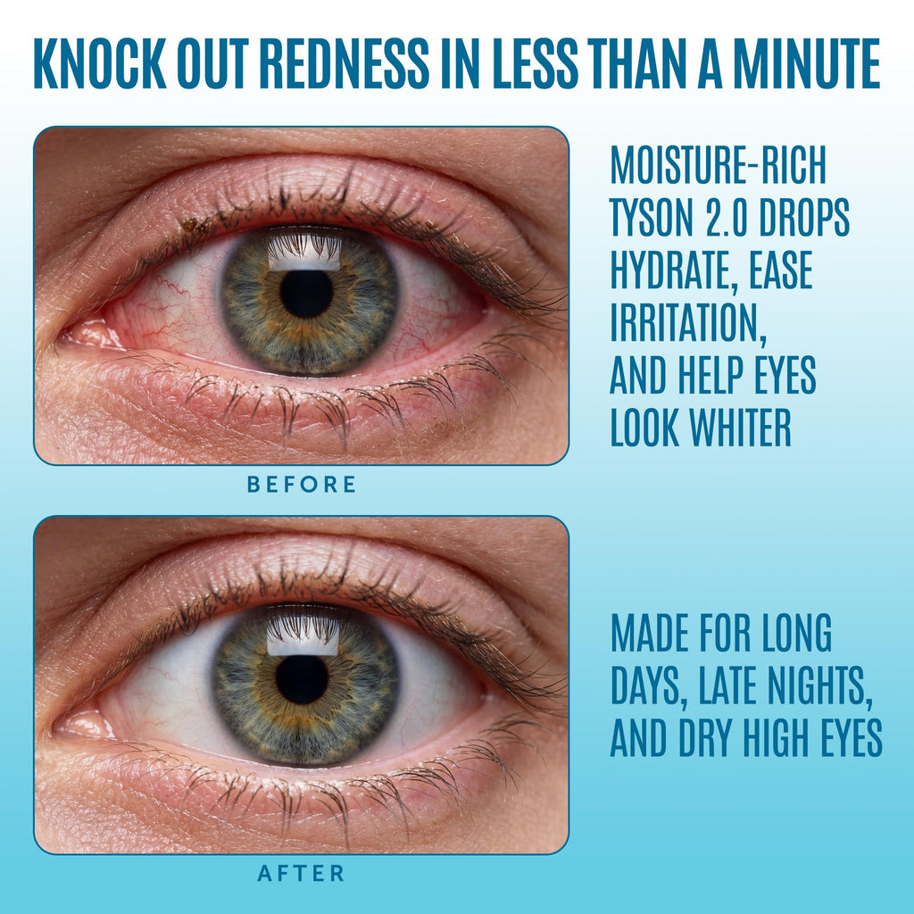 Moisture-rich Tyson 2.0 Mike Red Eye Drops effectively reduce redness, perfect for long days. Available at Curat Cart.