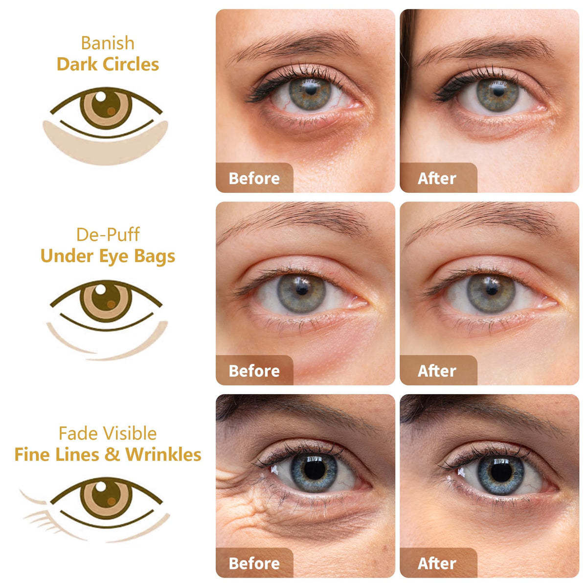 Transform your look with premium Under Eye Patches for Dark Circles from Curat Cart, showing visible results in reducing dark circles and fine lines.
