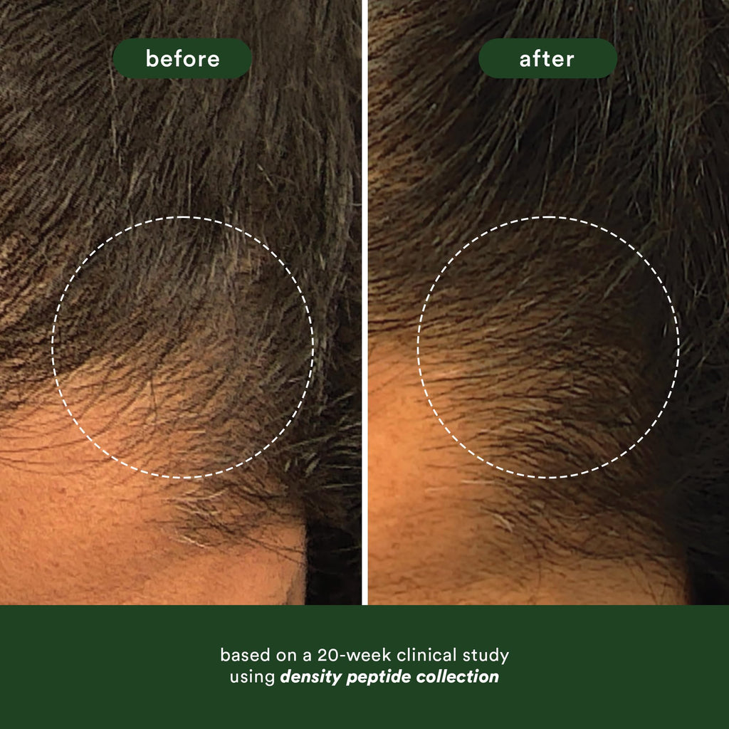 Visual comparison of hair density before and after using VERB Density Peptide Shampoo, showcasing significant improvement.