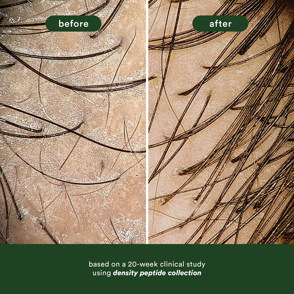 Before and after images show improved hair density. Available for online order—transform your hair with VERB Density Peptide Shampoo!