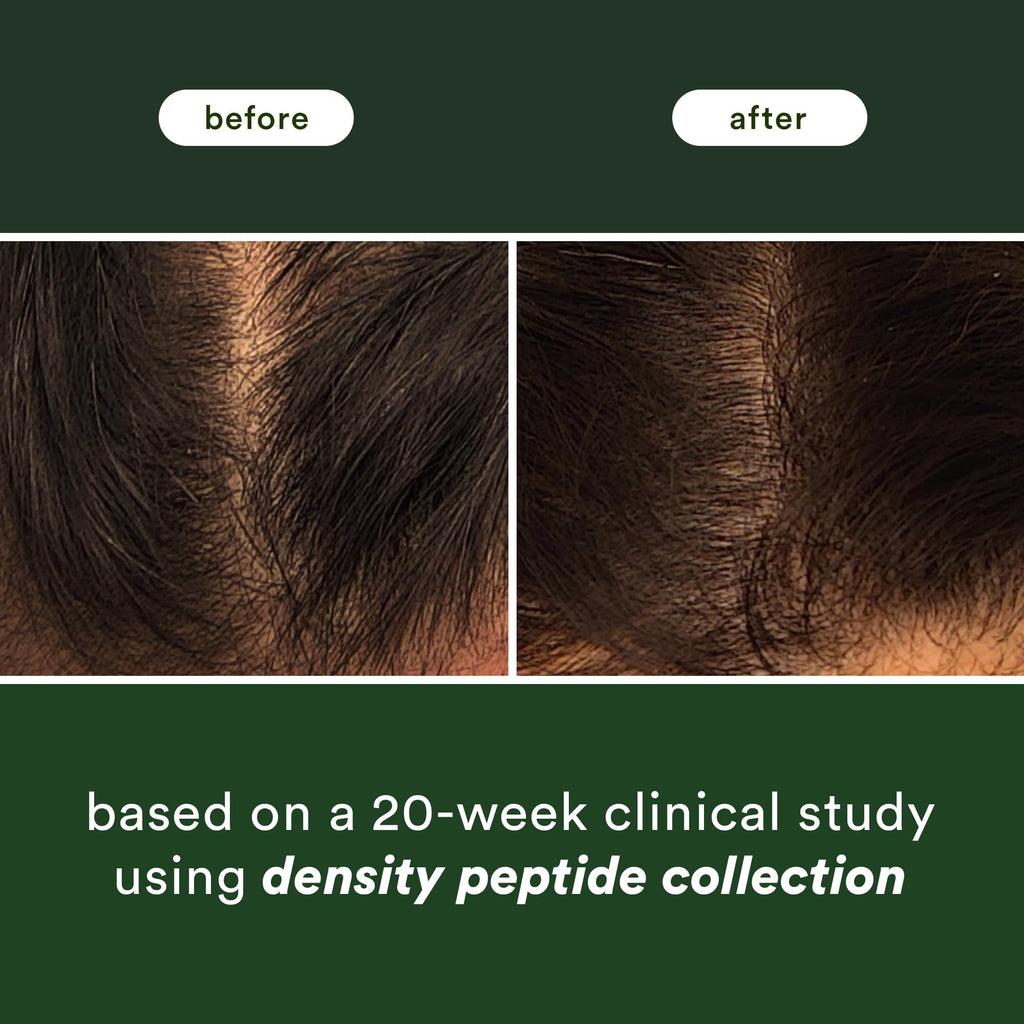 Authentic VERB Density Peptide Shampoo results: before and after images show visibly enhanced hair density after 20 weeks.