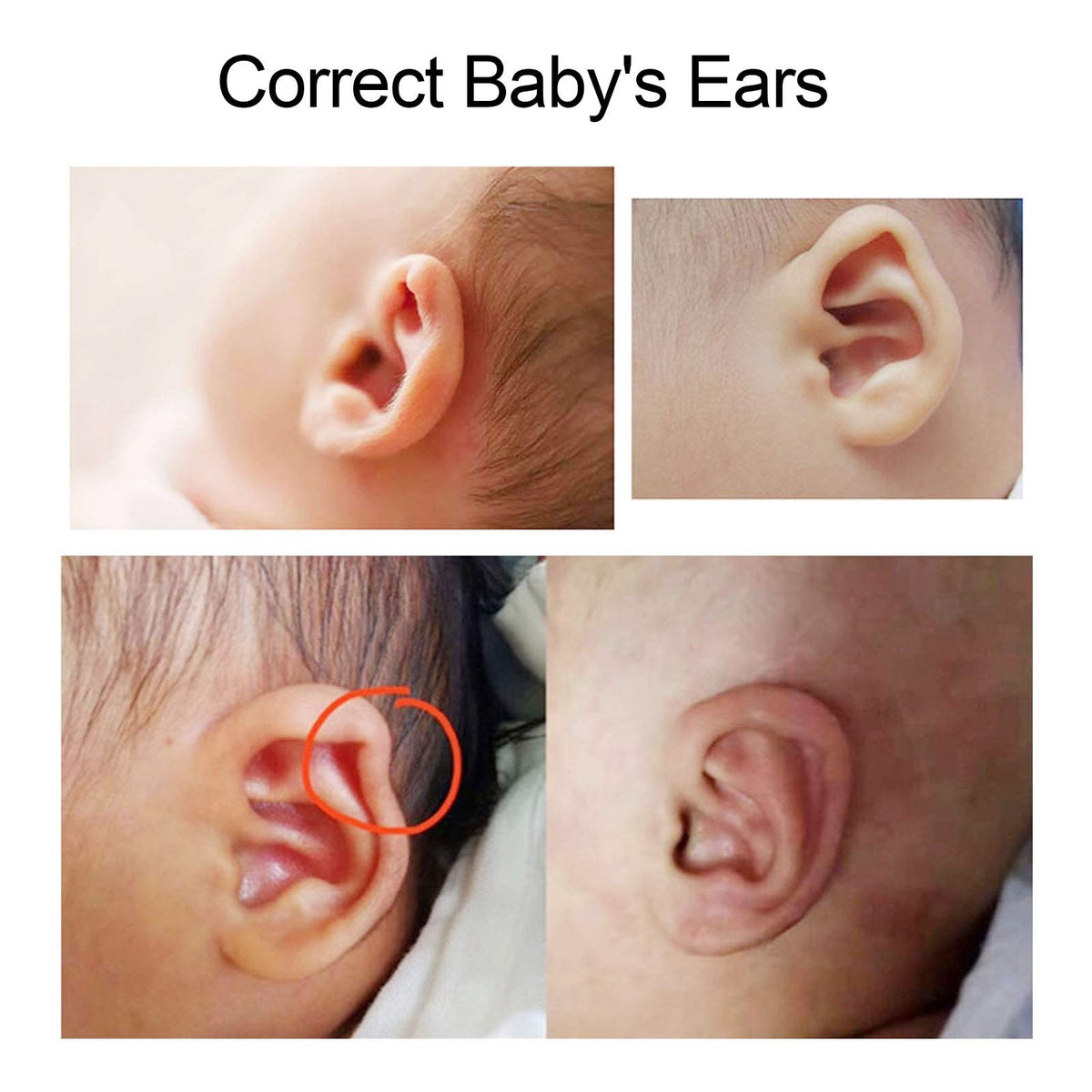 ZJchao Baby Ear Correction Patch - Ear Correction Patch Application Demonstration | Genuine Imported Product